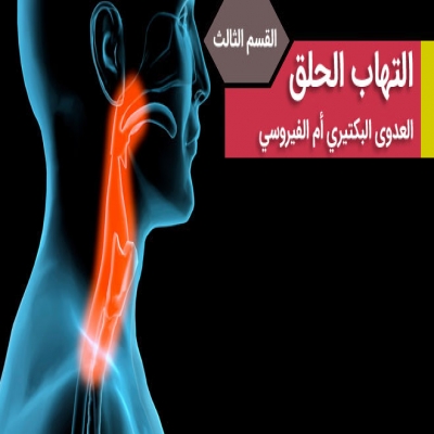 طب بديل-علاج و دواء التهاب الحلق بالأعشاب طب بديل-علاج و دواء التهاب الحلق بالأعشاب