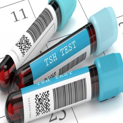 منوعات طبية-كل ما تريد معرفته عن تحليل tsh تى اس اتش