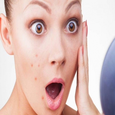 العناية بالبشرة-ماسكات مفضلة للحصول على بشرة خالية من حب الشباب والندبات العناية بالبشرة-ماسكات مفضلة للحصول على بشرة خالية من حب الشباب والندبات