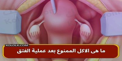 ما هى الاكل الممنوع بعد عمل عملية جراحة الفتق .. كل التفاصيل