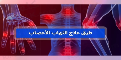 طرق علاج وتشخيص التهاب الأعصاب للاطراف فى الجسم