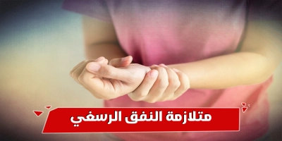 متلازمة النفق الرسغي بسبب استخدام الكمبيوتر لفترات طويلة